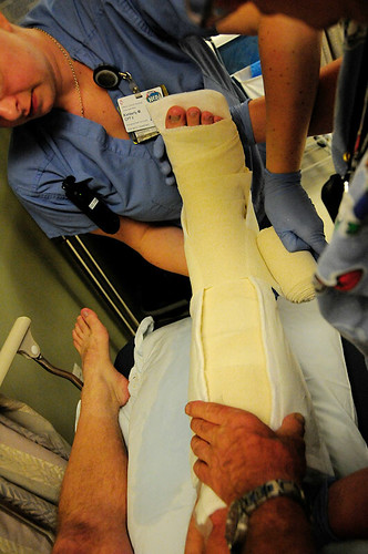 Travel Insurance Guide: leg in a cast